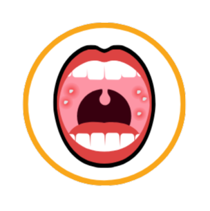 Measles symptoms can include tiny white spots called Koplik spots on the inside of the mouth